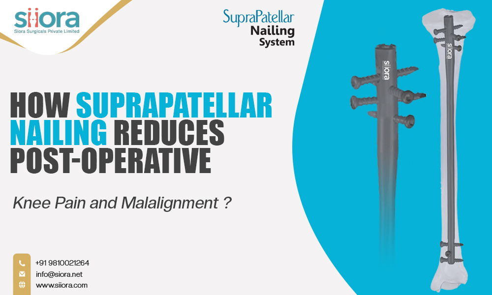 How Suprapatellar Nailing Reduces Post-Operative Knee Pain and&nbsp;Malalignment?